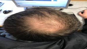 Hair